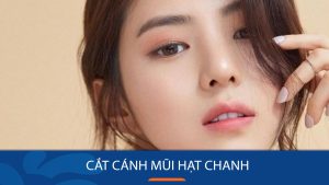 Cắt cánh mũi hạt chanh: Bí quyết sở hữu dáng mũi hoàn hảo