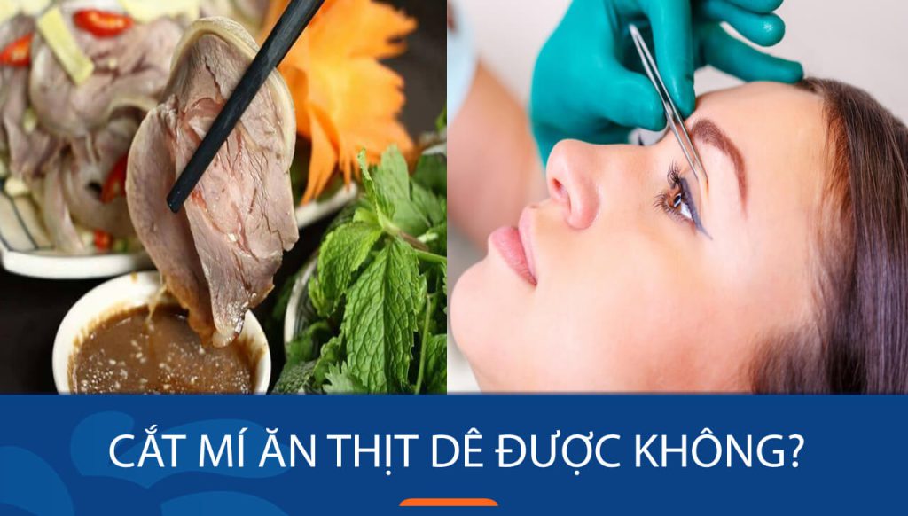 Cắt mí ăn thịt dê được không? Lời khuyên từ chuyên gia dinh dưỡng.