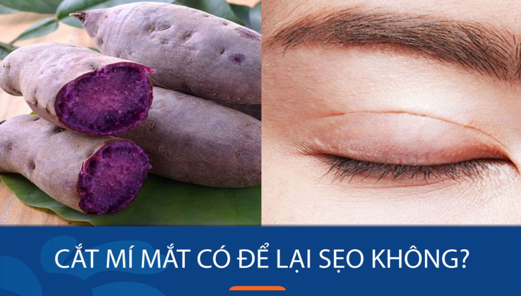 Cắt mí mắt ăn khoai lang được không? Giải đáp chi tiết