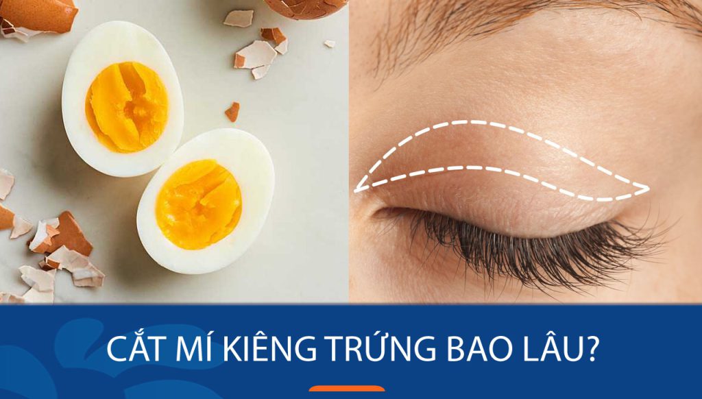 Cắt mí kiêng trứng bao lâu? Giải đáp chi tiết từ chuyên gia