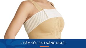 Bí quyết chăm sóc sau nâng ngực giúp bạn hồi phục nhanh chóng