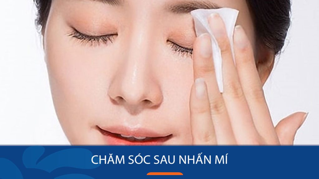 Chăm sóc sau nhấn mí chuẩn chỉnh: Hé lộ bí kíp đánh bay mọi khuyết điểm để sở hữu đôi mắt đẹp tự nhiên