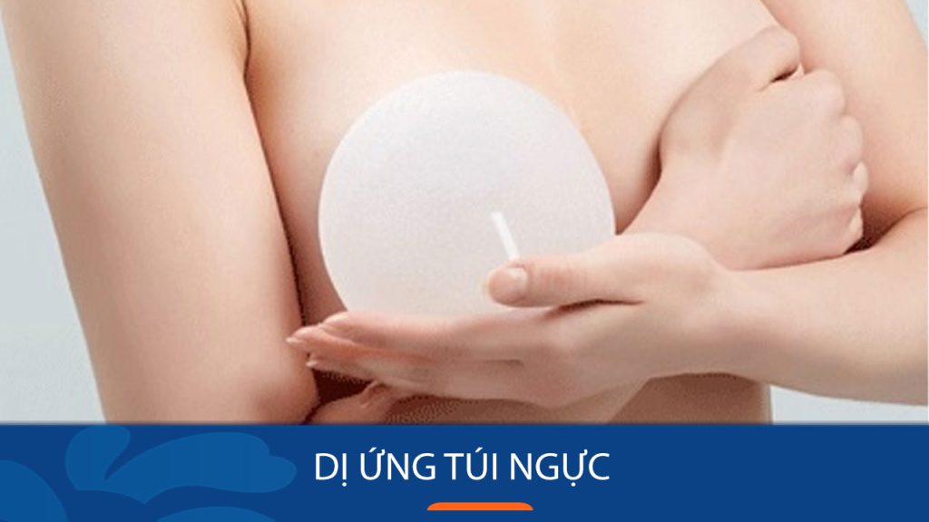 Dị ứng túi ngực: Triệu chứng, nguyên nhân và cách điều trị