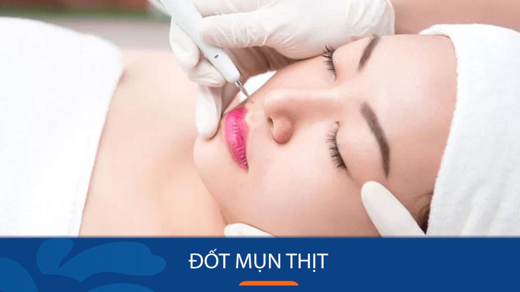Đốt Mụn Thịt Laser CO2 Fractional: Giải Pháp Hiệu Quả Cho Làn Da Mịn Màng