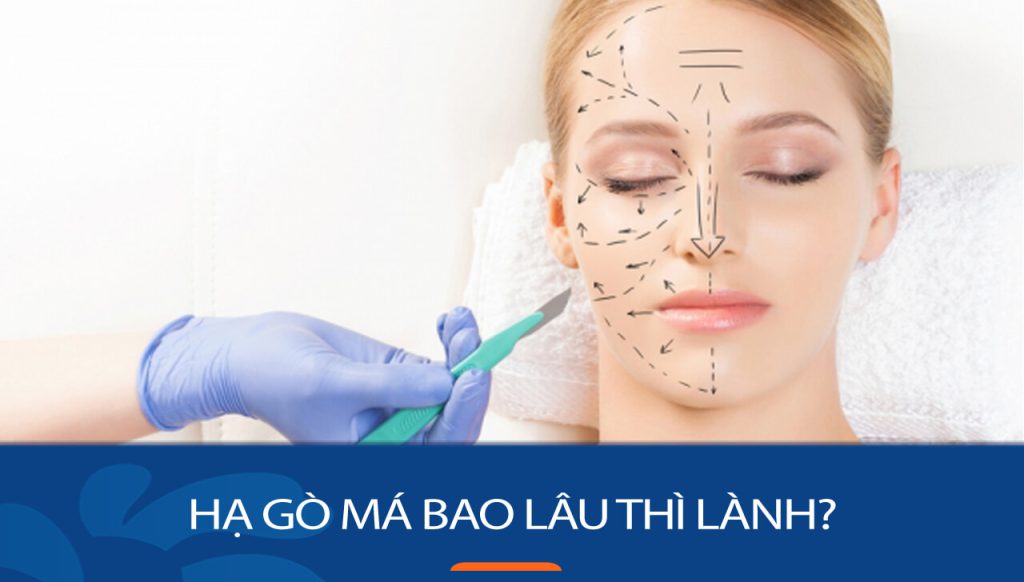 Hạ gò má bao lâu lành? Bí quyết giúp bạn phục hồi nhanh chóng và an toàn