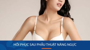 Sau phẫu thuật nâng ngực bao lâu thì ngực trở nên mềm