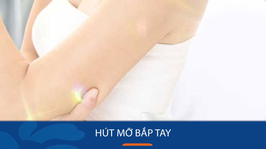 Hút mỡ bắp tay là gì? có đau không, có nguy hiểm không, giá bao nhiêu tiền