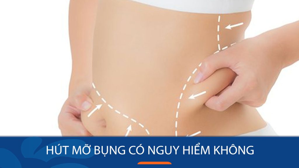 Hút mỡ bụng có nguy hiểm không – Tất cả những gì bạn cần biết