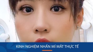 Nhấn mí mắt: Giải đáp mọi thắc mắc, chia sẻ kinh nghiệm “chuẩn chỉnh”