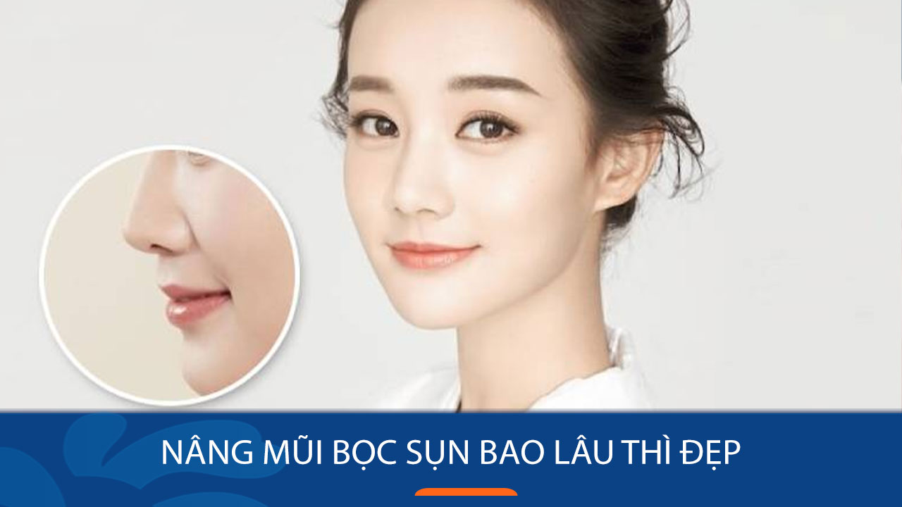 Nâng mũi bọc sụn bao lâu thì đẹp? Bí quyết để có kết quả hoàn hảo