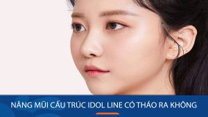 Nâng mũi cấu trúc Idol Line có tháo ra được không? Giải đáp từ chuyên gia