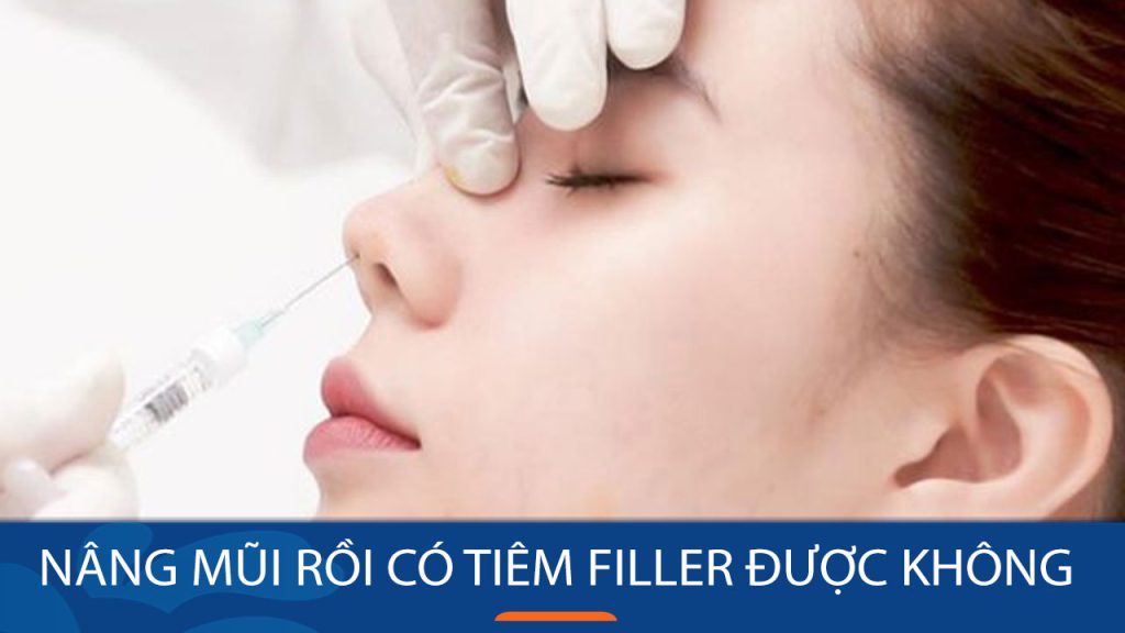 Có thể tiêm filler sau khi nâng mũi? 4 điều cần lưu ý