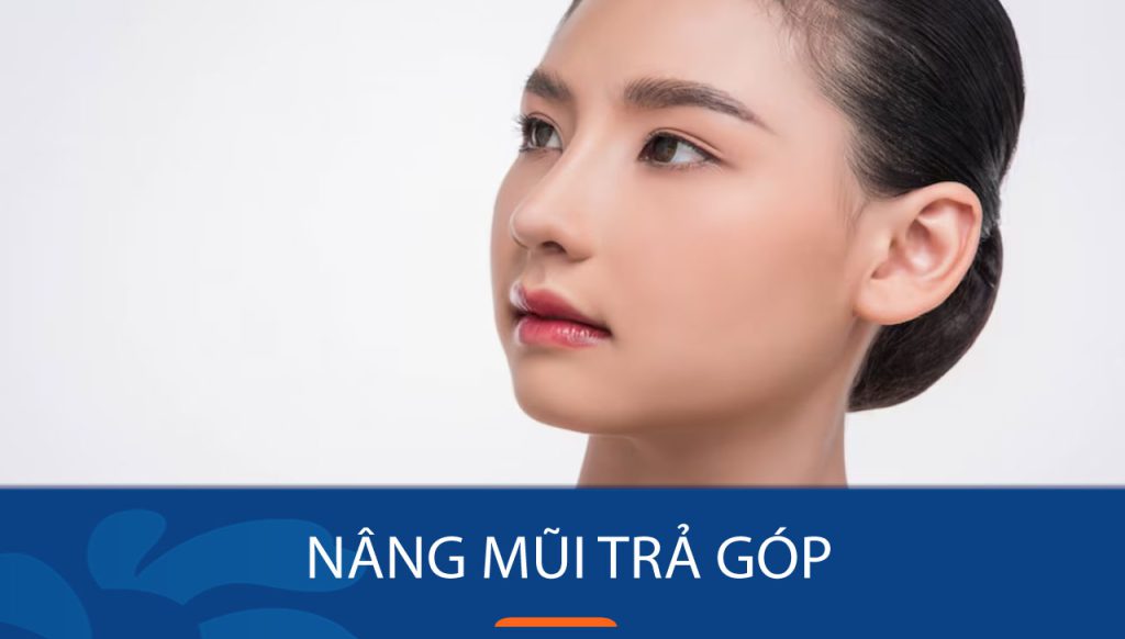 Nâng mũi trả góp có cần thẻ tín dụng không?