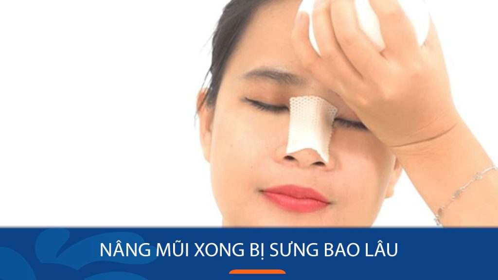 Nâng mũi xong bị sưng sau phẫu thuật : mẹo giảm sưng nhanh