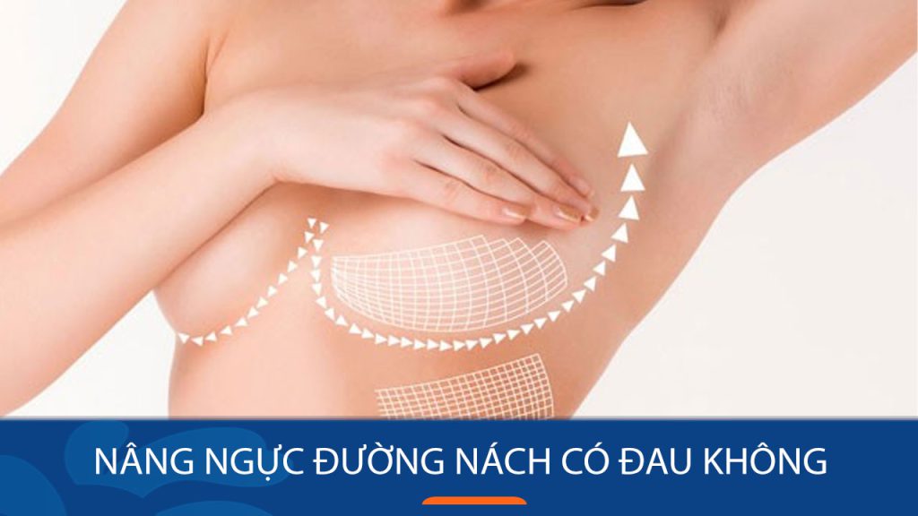 nâng ngực đường nách có đau không? Cách kiểm soát cơn đau