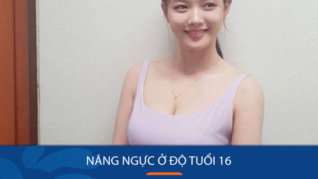 Những điều cần biết khi nâng ngực ở độ tuổi 16