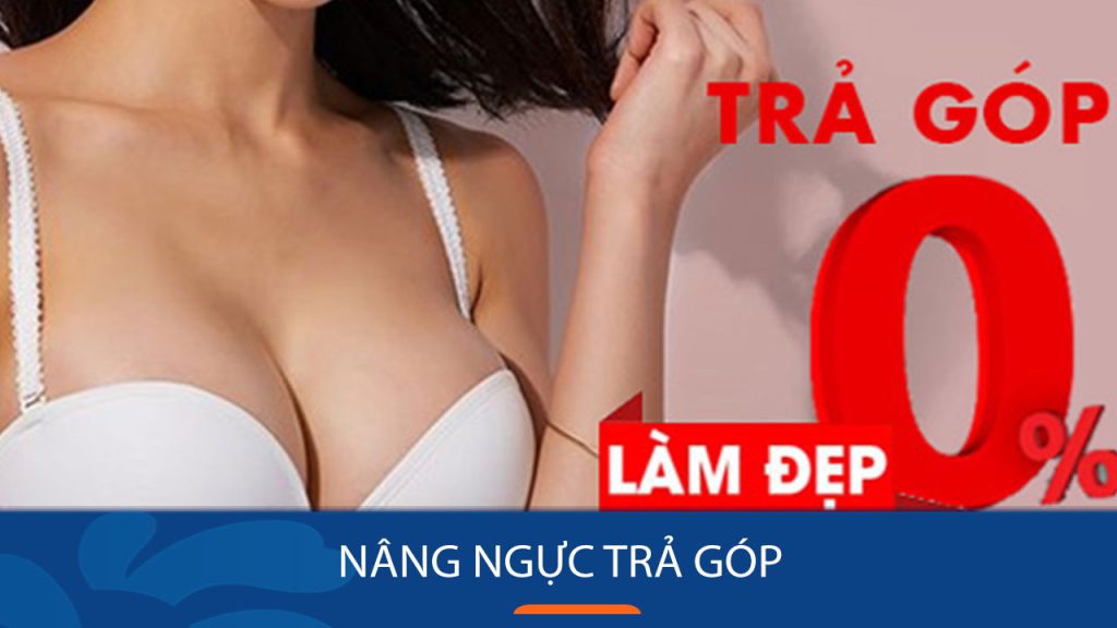 Nâng ngực trả góp lãi suất 0% – Cơ hội sở hữu vòng 1 đẹp không lo gánh nặng tài chính