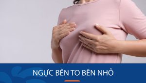 Ngực bên to bên nhỏ: Bí quyết khắc phục ngực to bên nhỏ hiệu quả