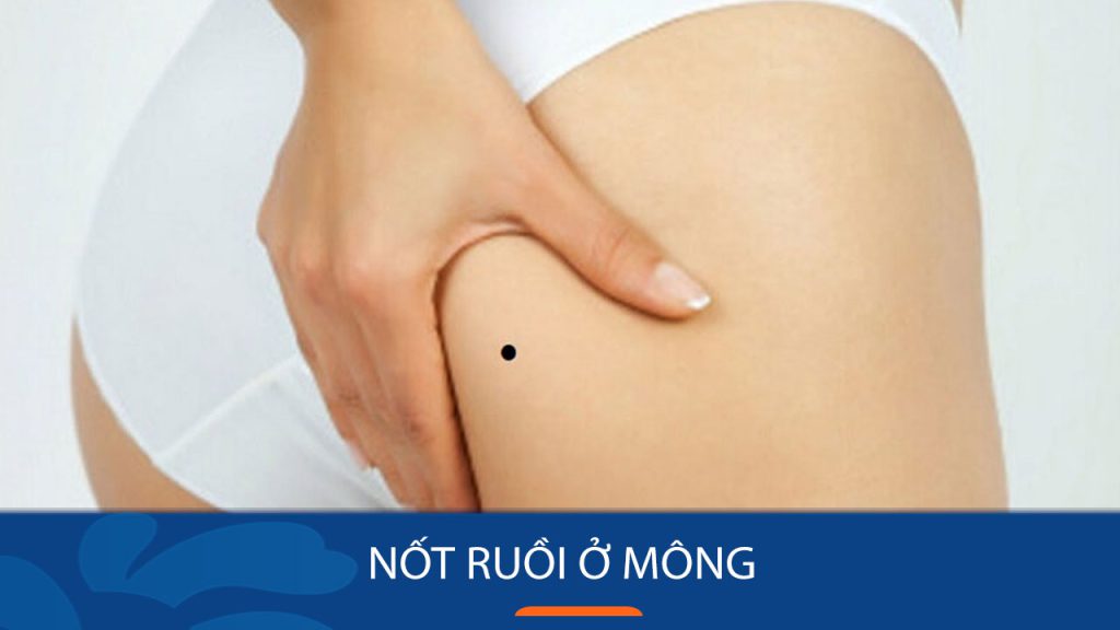 Bí Mật Nốt Ruồi Mông Trái & Phải: Giải Mã 90% Tình Duyên & Sự Nghiệp