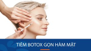 Tiêm botox gọn hàm mặt : ưu nhược điểm bạn cần biết