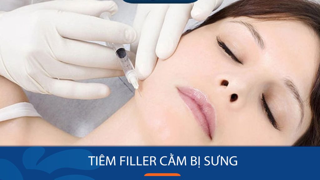 Tiêm filler cằm bị sưng: Nguyên nhân, biểu hiện và cách giảm sưng hiệu quả