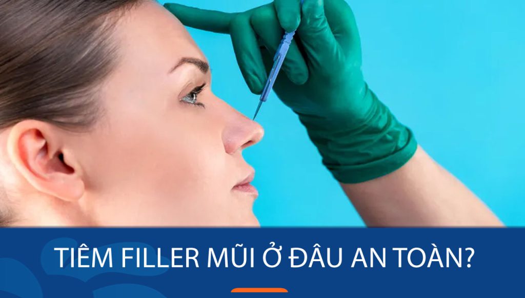 Tiêm filler mũi ở đâu an toàn – Bệnh viện thẩm mỹ Kangnam