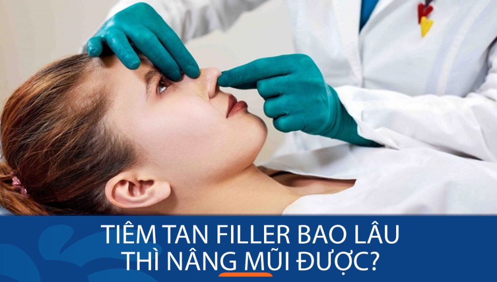 Tiêm filler tan bao lâu thì có thể nâng mũi? Lưu ý không thể bỏ qua