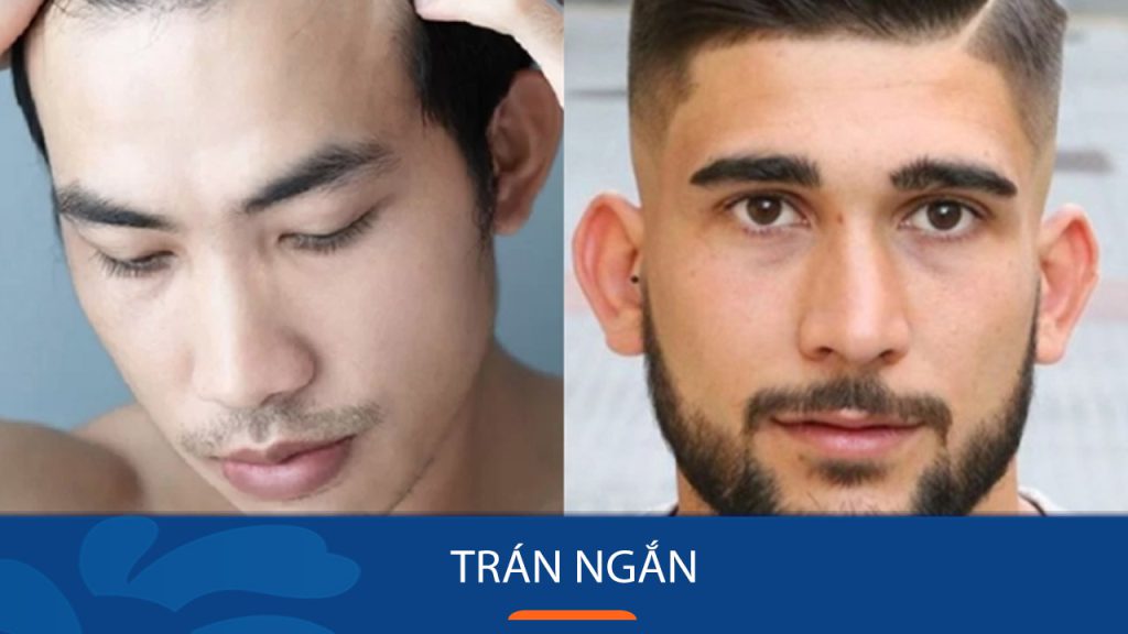 Trán Ngắn, Hẹp, Thấp là gì? 6 kiểu tóc đẹp dành cho trán ngắn