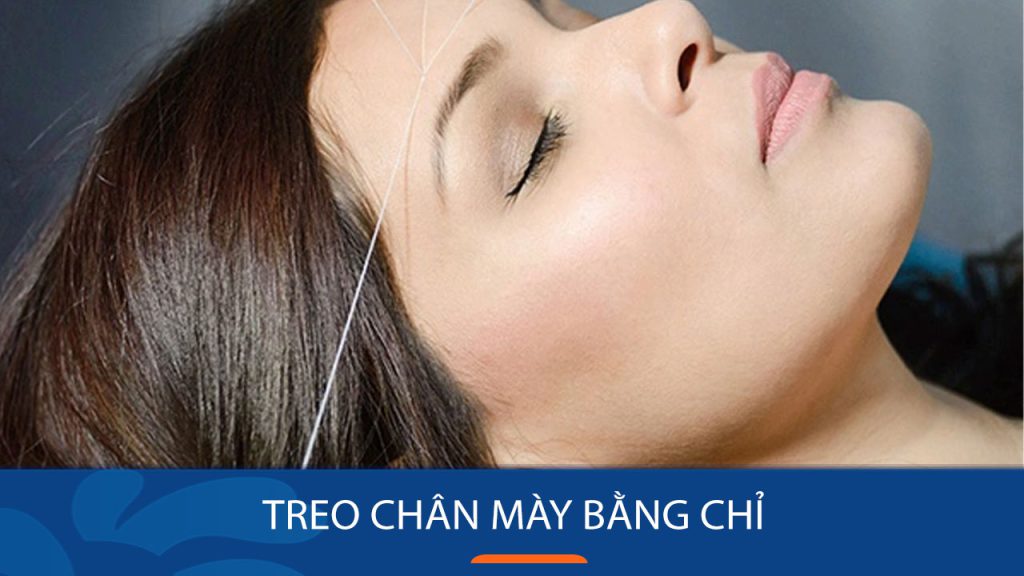 Treo chân mày bằng chỉ có hiệu quả không? Giải đáp bí ẩn