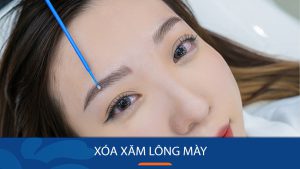 Cách xóa xăm lông mày đảm bảo không để lại sẹo