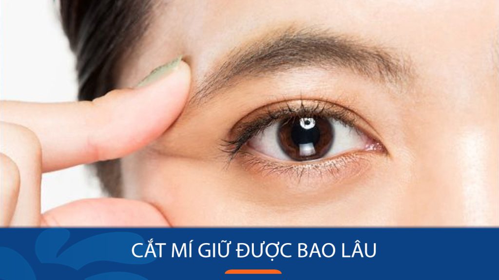 Cắt mí giữ được bao lâu? những yếu tố ảnh hưởng