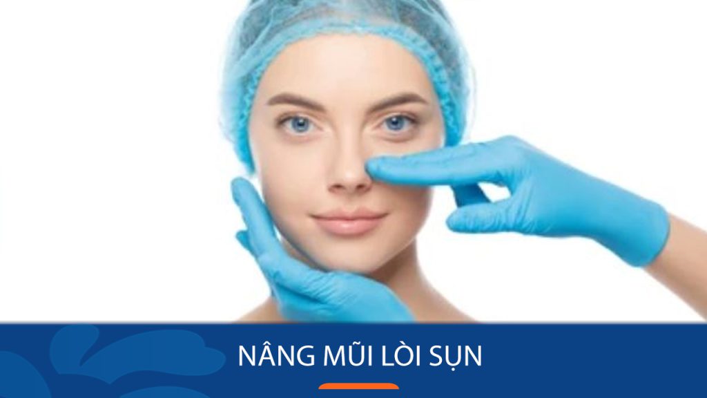 Nâng mũi lòi sụn: Cách thực hiện và quá trình phục hồi