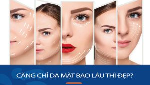 Căng Chỉ Da Mặt Bao Lâu Hiệu Quả? Bí Quyết Chăm Sóc Sau Khi Căng Chỉ