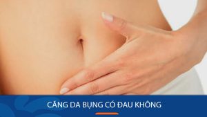Căng da bụng có đau không: Bác sĩ kangnam giải đáp
