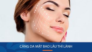 Căng da mặt bao lâu thì lành? Giải đáp thắc mắc về thời gian phục hồi