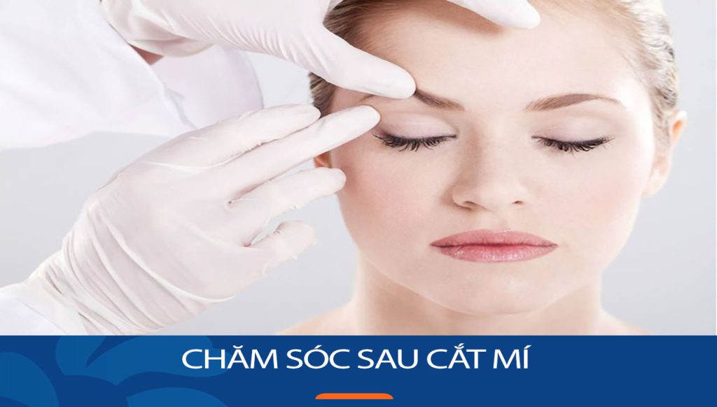 Chăm sóc sau cắt mí đúng cách: Bí quyết để có đôi mắt đẹp hoàn hảo