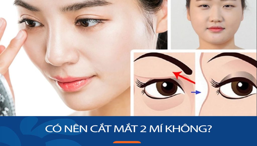 Cắt mắt 2 mí: “Nên” hay “không nên”? Lời khuyên từ chuyên gia