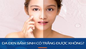 Da đen bẩm sinh có trắng được không? Làm đẹp da