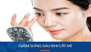 Mẹo giảm sưng sau khi cắt mí mắt: Những lưu ý quan trọng