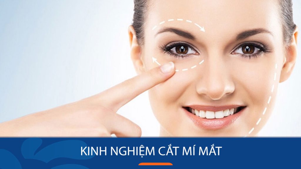 kinh nghiệm cắt mí mắt “lột xác” nhan sắc: Bí quyết “chuẩn chỉnh