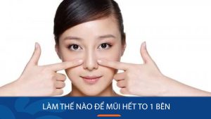 Mũi to một bên bé một bên: Nguyên nhân và cách khắc phục hiệu quả