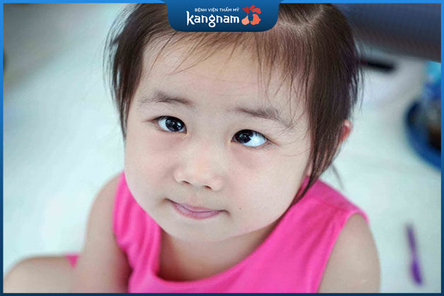 Giai đoạn trong bụng mẹ phát triển không đều ở cơ mắt dẫn đến hiện tượng các bé bị lé khi sinh ra 