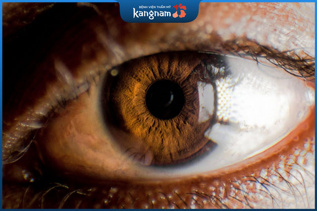 Mắt màu nâu nhạt hay đậm tùy thuộc vào cấu trúc tế bào mắt 