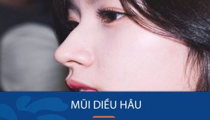 Mũi diều hâu là gì? Mũi diều hâu ảnh hưởng gì đến tướng số?