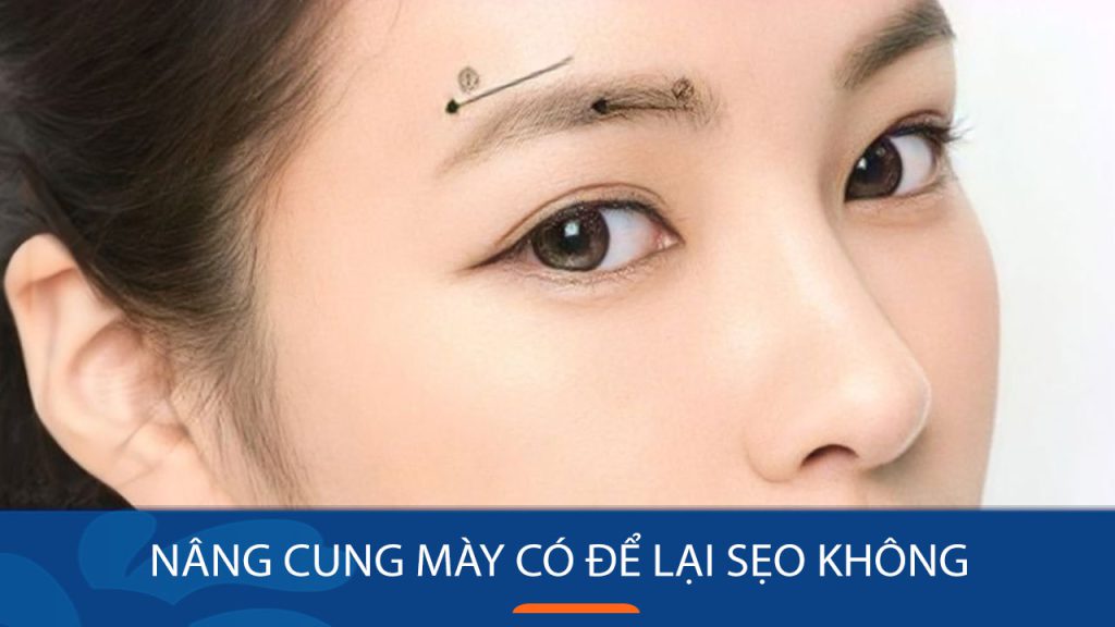 Nâng cung mày có để lại sẹo không và cách chăm sóc không để lại sẹo