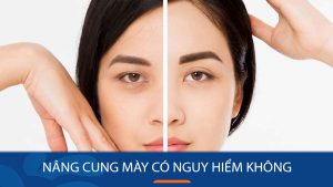 Nâng cung mày có nguy hiểm không? Cách hạn chế rủi do tối đa