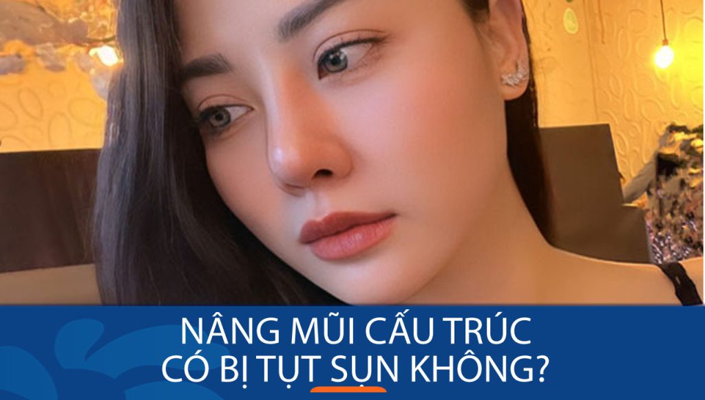 Phương pháp nâng mũi cấu trúc có thể gây tụt sụn không