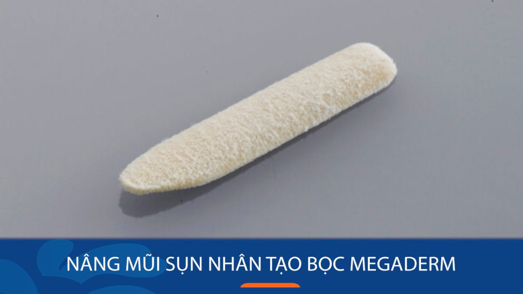 Nâng mũi sụn nhân tạo bọc Megaderm – sự lựa chọn tốt nhất
