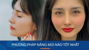 Nâng mũi phương pháp nào tốt nhất? Giải đáp thắc mắc từ A đến Z