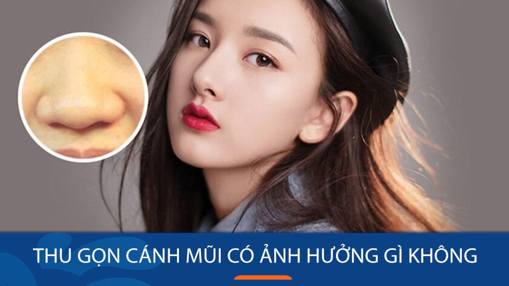 Thu gọn cánh mũi: Có nên thực hiện và ảnh hưởng của quá trình này